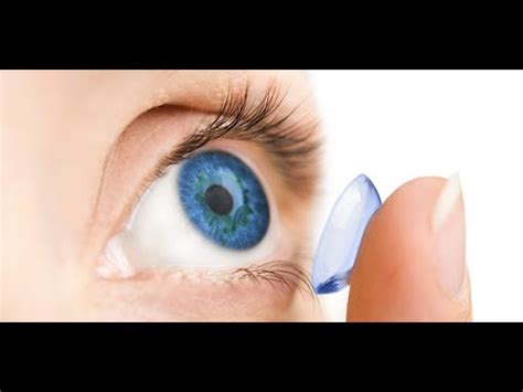 Doctors Have Found Contact Lenses Lost In A Woman S Eye Youtube