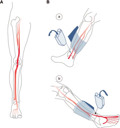 Lower Extremity Circulation And The Abi Test A Anterior View Right