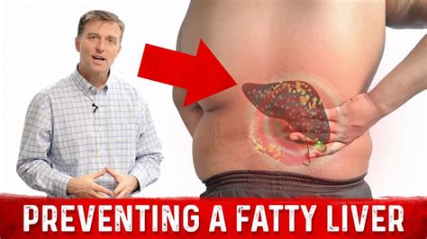 How To Prevent Fatty Liver When You Lose Weight Dr Berg Youtube