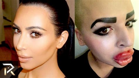 People Who Have Had Horrible Plastic Surgery Before And After