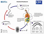 Hookworm infection: life cycle, transmission, pathogenesis, diagnosis ...