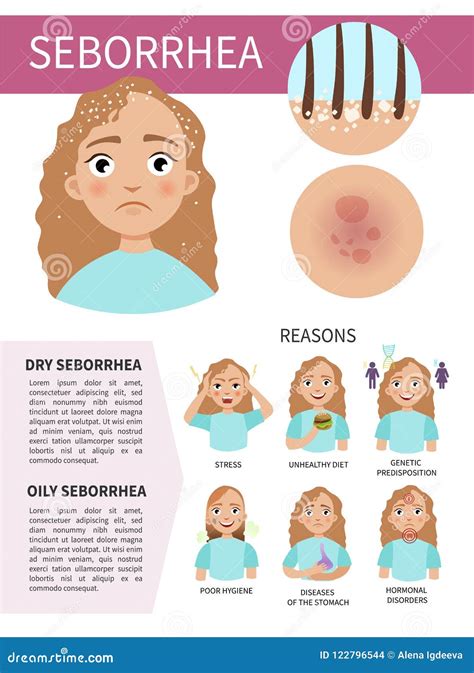 Skin Disease Infographic Stock Vector Illustration Of Beautiful