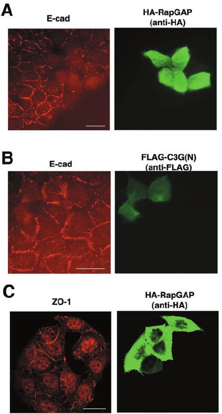 Role Of Rap1 In E Cadherin Localization After Microinjec Tion Mcf7
