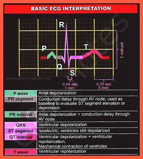 Ecg Patterns And Explanation