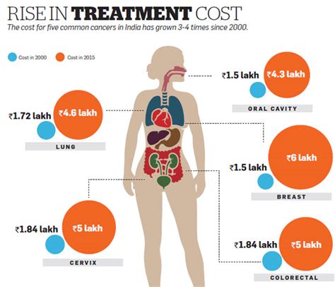 Can You Bear The Cost Of Cancer Treatment Find Out How To Buy The Best