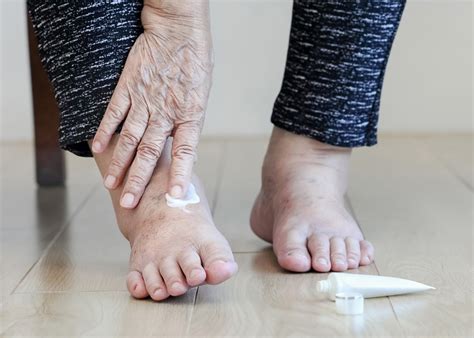 Artrosis en los pies Causas síntomas y consejos para esta enfermedad