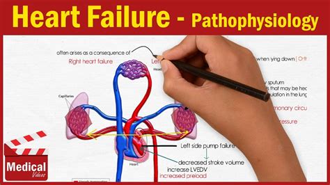 Pharmacology Cvs 10 Heart Failure Pathophysiology Made Easy Youtube