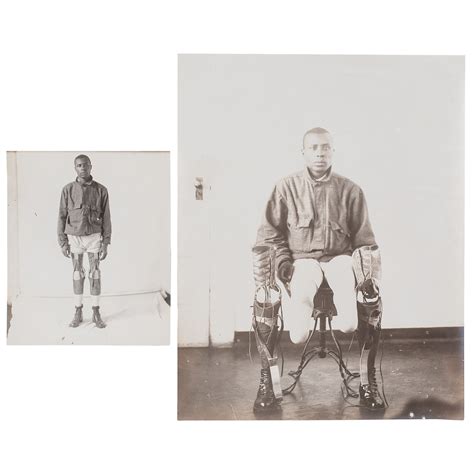 Wwi African American Veteran Amputee With Prosthetic Legs Circa 1918