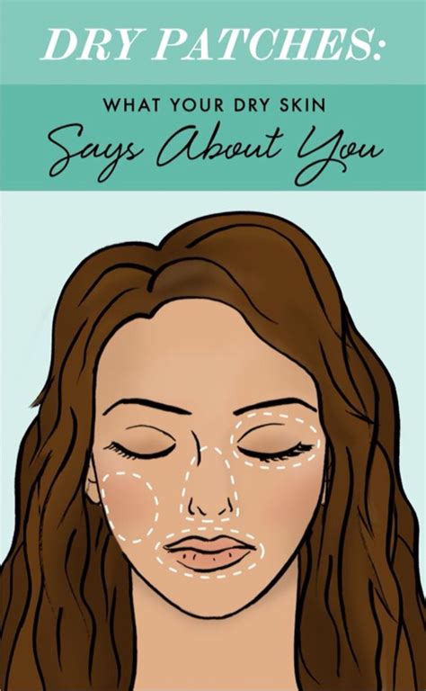 Dry Patches What Your Dry Skin Says About You 😱💯👍🏻 Musely
