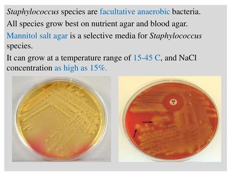 Ppt Pyogenic Cocci The Grams Positive Cocci 1 Staphylococci 2