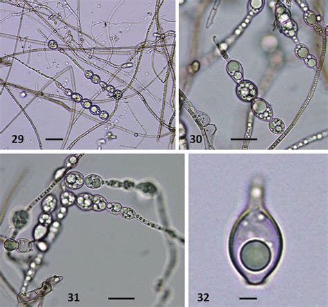 Mycelium And Chlamydospores Of Corollospora Sp 2 Md1206 From Natural