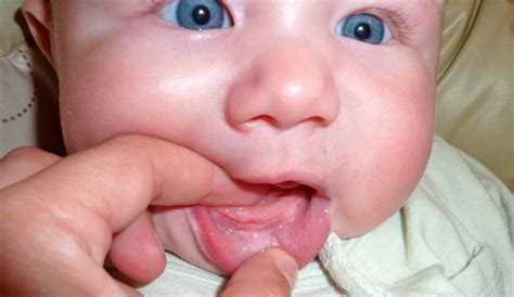 Ріжуться зубки що робити коли ріжуться зуби у малюка Як допомогти