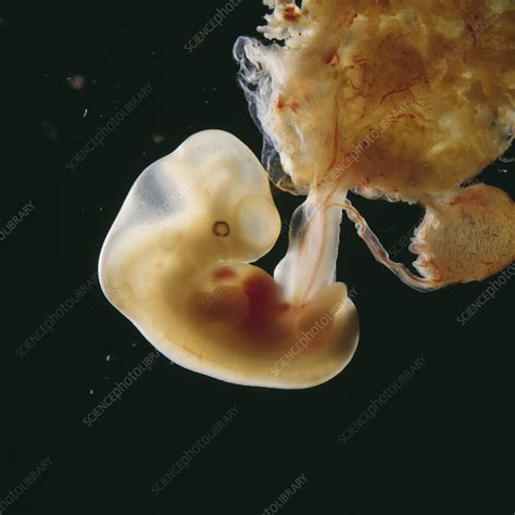 Embryo And Placenta Five Weeks Stock Image C0487851 Science