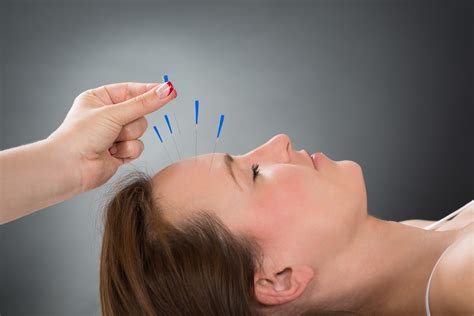 Acupuncture Helpful For Acute Preventive Treatment Of Migraine But Higher Quality Evidence