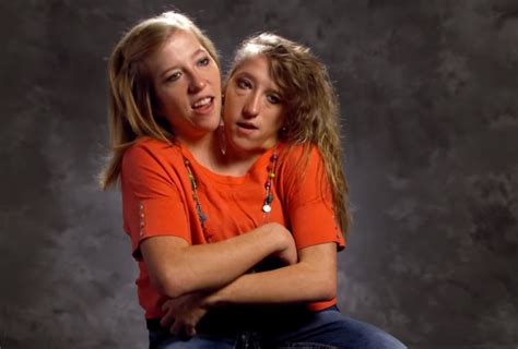 What Famous Conjoined Twins Abby And Brittany Hensel Are Doing Today Hot Sex Picture