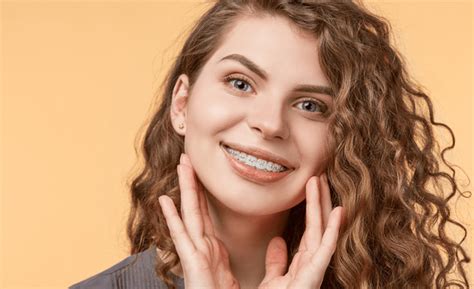 How Long Do Braces Take To Straighten Teeth Impressions Smile