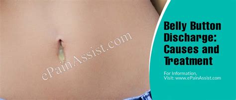 How To Cure Belly Button Infection Creativeconversation