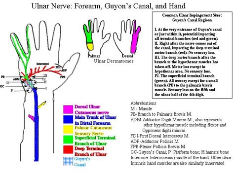 Ulnar Neuropathy Guyons Canal Ulnar Nerve Neuropathy Hand Therapy