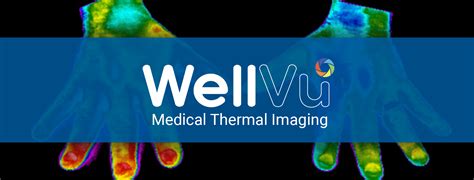 Wellvu Medical Thermal Imaging