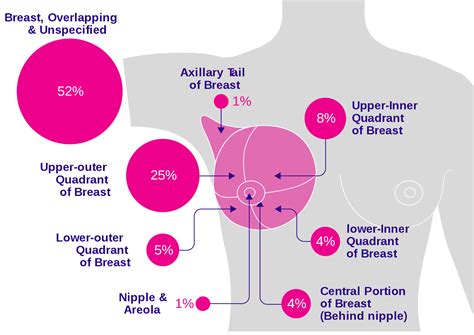What Is Breast Cancer Breast Cancer Symptoms Risk Factors And