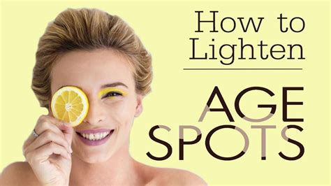 How To Get Rid Of Age Spots Naturally Home Remedies For Age Spots