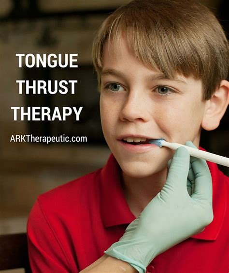 Tongue Thrust Therapy Ark Products Llc