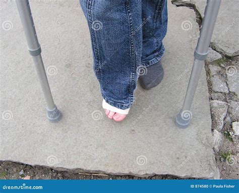 Sprained Ankle And Crutches Stock Photo Image Of Feet Strain 874580