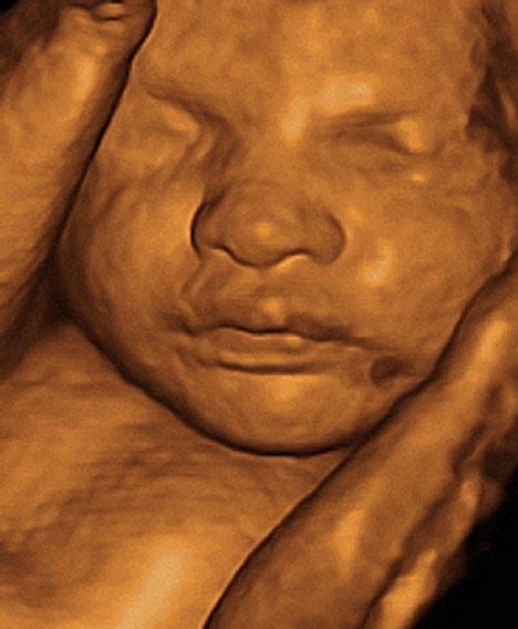 Raymond Davis Blog 3d Ultrasound Images At 28 Weeks