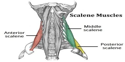Scalene Myofascial Pain Syndrome Cause Symptoms Treatment