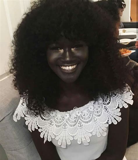 Teen Bullied For Her Incredibly Dark Skin Color Becomes A Model Takes