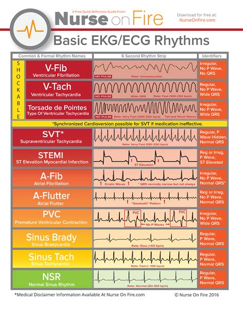Basic Ekg Ecg Rhythms Cheatsheet Basic Ekg Ecg Rhythms V Fib V Tach