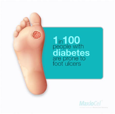 Diabetic Foot Ulcers Risk Factors Symptoms And Treatment Axiobio