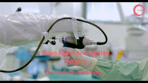 Robotic Surgery The Future Of Orthopaedics Youtube