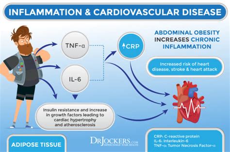 Visceral Fat What Is It And How It Drives Up Inflammation