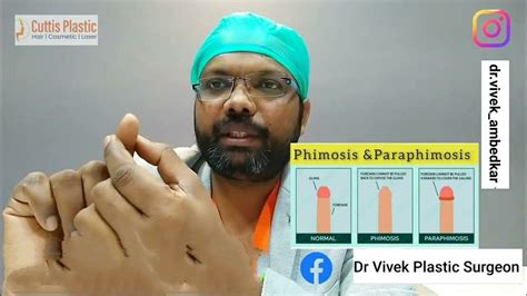 Difference Between Paraphimosis And Phimosis Paraphimosis Treatment