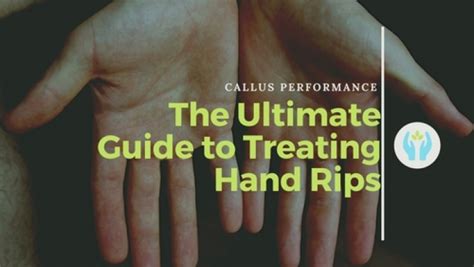 The Ultimate Guide To Treating Hand Rips