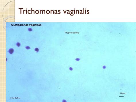 Ppt Trichomonas Vaginalis Ve Zg R Amipler Powerpoint Presentation Id