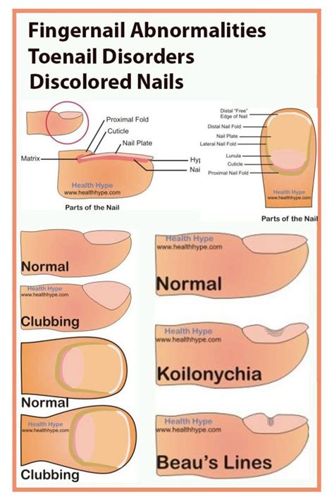 Tips For Nail And Tongue Health Tips Healthy Natural Magazine Toe