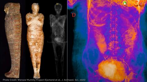 Archaeologists Discover Worlds First Pregnant Ancient Egyptian Mummy Bcg