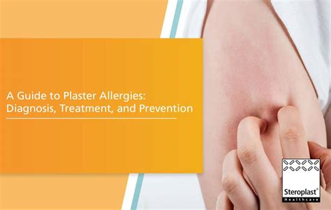 A Guide To Plaster Allergies Diagnosis Treatment And Prevention