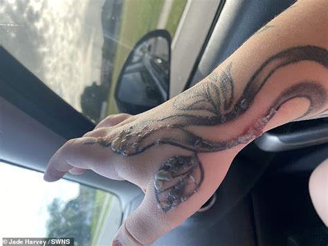 A Mother Was Left Reeling After An Tattoo Left Her With Huge Warts