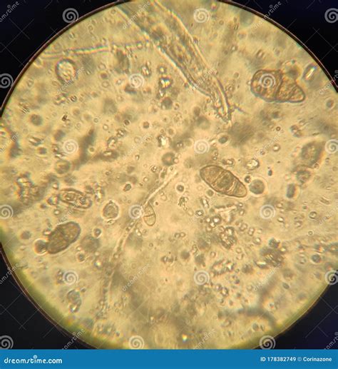 Alternaria Fungal Spores Under The Microscope Stock Image Image Of