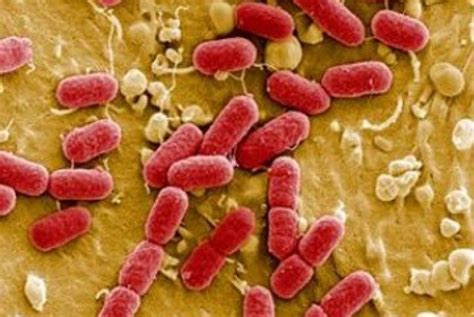 Mengenal Bakteri E Coli Penyebab Mahasiswa Ub Keracunan Makanan
