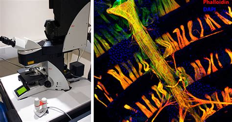 Confocal Microscopy Icahn School Of Medicine