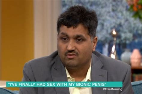 This Morning Fans Praise Guest Who Lost His Virginity With Bionic Penis