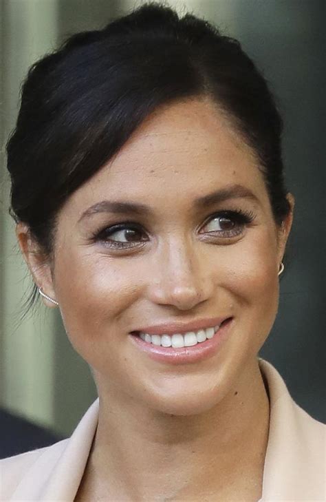 Meghan Markle Women Request Nose Freckle Treatment To Look Like Royal Au