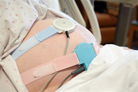 Image Pregnancy Fetal Monitor Sensors On Woman Large Canvas Print Buy