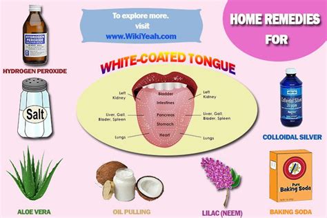 14 Tips To Get Rid Of White Tongue Coating At Home Fast White Tongue