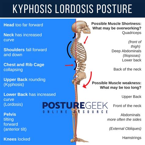 Kyphosis Lordosis Posture