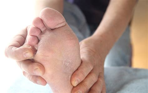 Athletes Foot Foot And Ankle Specialists In Kelso Tweed Podiatry